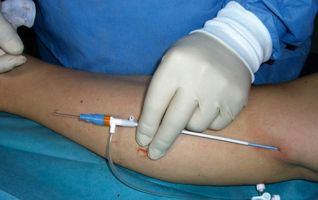 clinicas abdominoplastia en managua Clínica Medica Especializada Varices Nicaragua